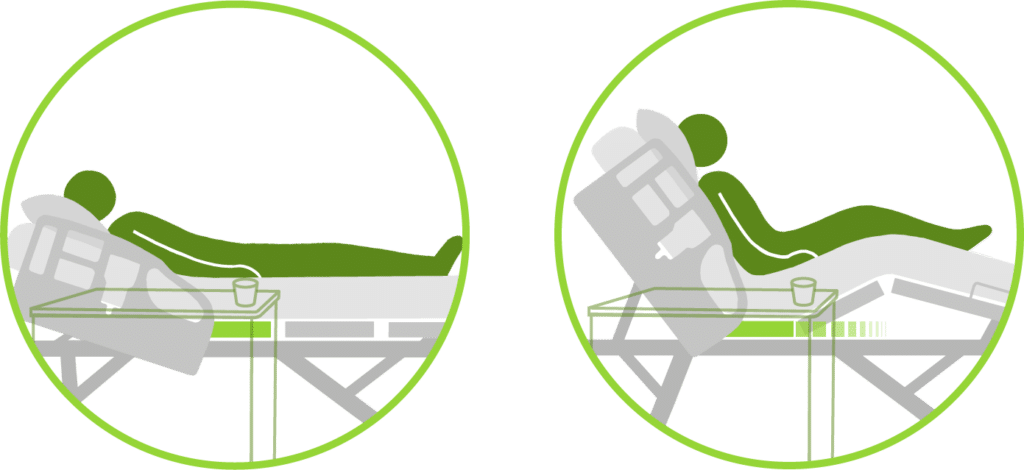 Glidealign Retractable Deck Technology